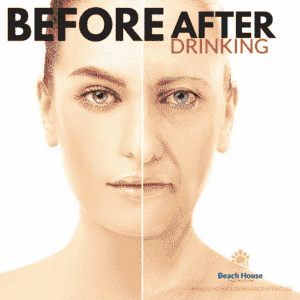 before_after_alcohol_drinking_beach_house_center_for_recovery